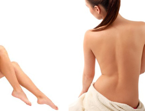 POSTURA SCORRETTA E CELLULITE