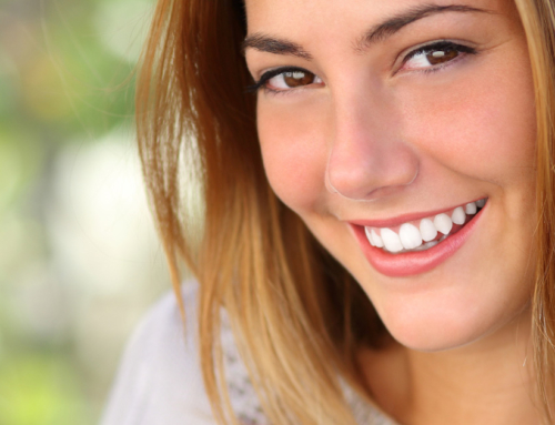 L’estetica del sorriso
