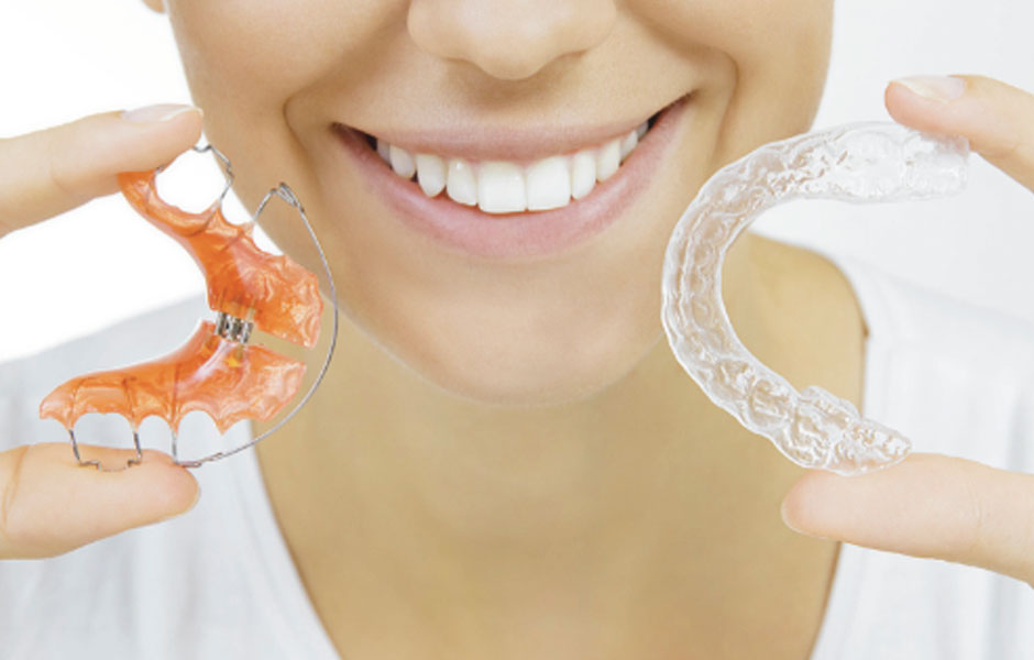 Invisalign: trattamenti a confronto